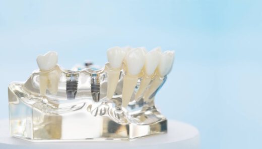 Niedoczynność tarczycy a implanty dentystyczne